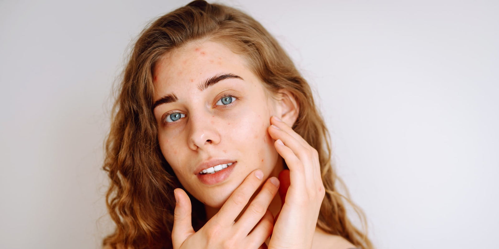 Junge Frau mit Akne im Gesicht betrachtet ihre Haut im Spiegel und berührt vorsichtig eine entzündete Stelle.