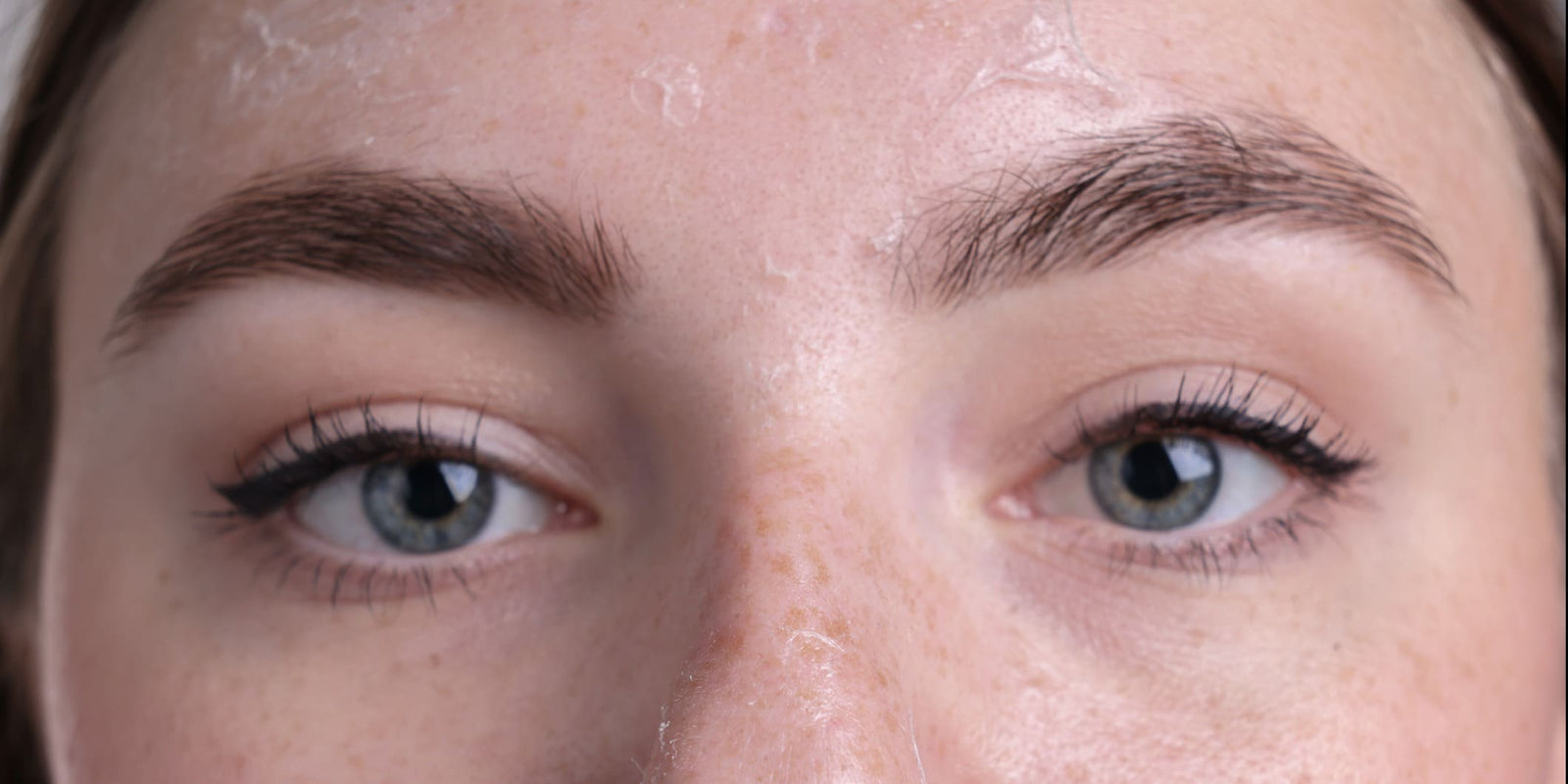 Gesicht mit Anzeichen von Feuchtigkeitsmangel und Trockenheit auf der Haut